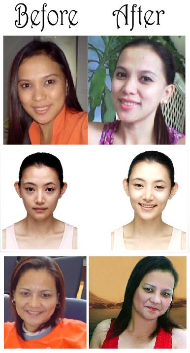 before_after_skin_whitening_cream