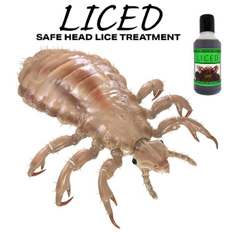 head lice treatment no chemicals